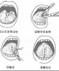 ������ϵ���̴����ȥ����Ժ���� Ҫ����