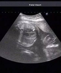 14��Ů�����̸�����3�껳�� ������˵...