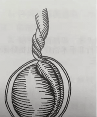 11���к���·�ܾ���ƨ�� ���¿���ҽ��̾Ϣ����������ס�� ��