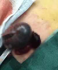 11���к���·�ܾ���ƨ�� ���¿���ҽ��̾Ϣ����������ס�� ��