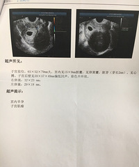 ˳�������ʸ���