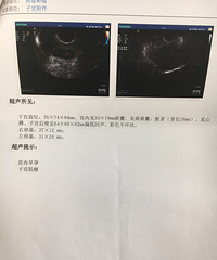 ˳�������ʸ���