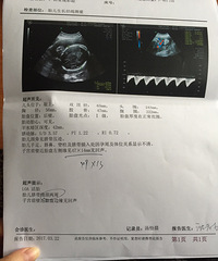 [����]�ӹ�ǰ�ڽ�̥�̱�Ե���޻��� �ƾ�2��