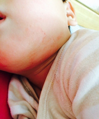 �����°ͺ���е���Ƥ ��ô�죿