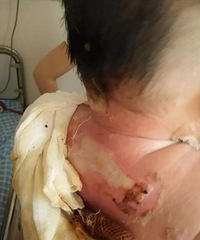 ��ʹ������Ӥ��ס���ҽԺ ��ҽ��������ָ���ҳ����ߡ�