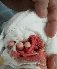 ��ʹ������Ӥ����ҽ��������ָ��