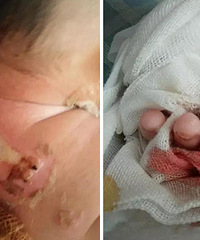 ��ʹ������Ӥ������ҽ��������ָ��