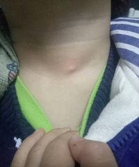 С����������һ��͹��