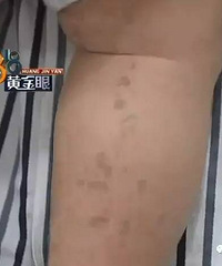 ŮӤ�Ҳ�С���кܶ���ɫ�ߺۣ��ҳ�����...