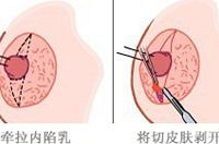 ���к���ͷ��ڡ����α�� �Ϲ�ͬ������˵���ö��ģ�