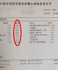 ���˷��ֳ���ϸ�� ���ƿ����ض�û�� ������30%