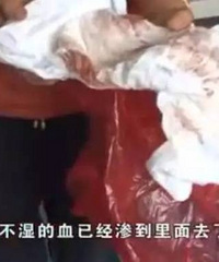 ������16���´�ŮӤ�������ַ�����ʪ��ȫ��Ѫ��