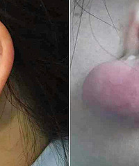 ���£�������� �����׳�4cm��ġ����򡱣�