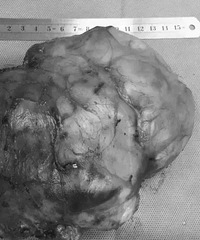 1���޲��ҿޣ������֣�ԭ���������ۡ�ԭ����...