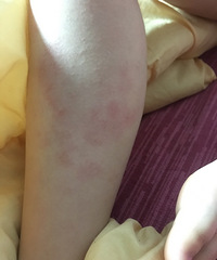 �Ҽұ���8���ˣ�������Щ��֪����ʪ��ǹ�������1����������