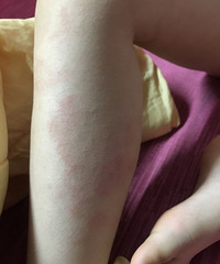 �Ҽұ���8���ˣ�������Щ��֪����ʪ��ǹ�������1����������