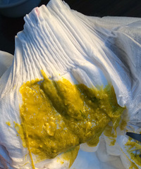 ҽ������