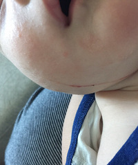 ���·�����Ƭ���˺ܳ�һ������Ѫ�ˣ��ܺ�ô����Ҫ��ҩ��ô