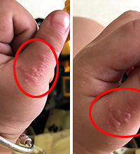 �������ϳ�һ������� Ϳҩ��û��