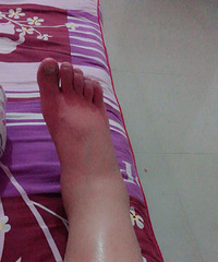 ��39�� ��ÿ���׵��ر����� �������׷���