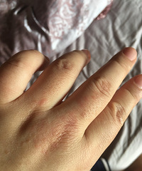 Ƥ������