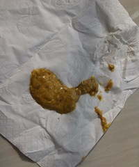 ��ҽ����С�����⼸���е㸹к��