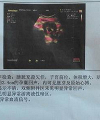 ������B�� ��￴����̥���л���Ů��