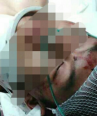 ��㤣�20¥����һ��ש ����С�ﱻ�ҵ�ͷ