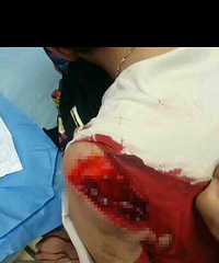 ���أ���������һС���˳�����������Ѫ�¼���ͼƬ��Ѫ�ȣ�