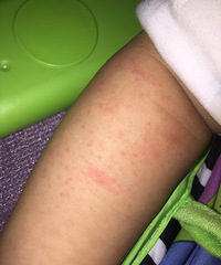 ��ã���ҽ���������ֱ�������һ�ſ����ȳ����Ļ�����ʪ���أ�