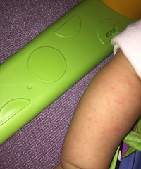 ��ã���ҽ���������ֱ�������һ�ſ����ȳ����Ļ�����ʪ���أ�