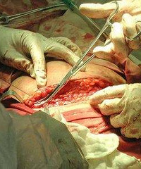 �������ڼ����и���Ժ�ʸ���Ҫ����Ǯ ס���죿