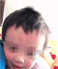 ��ʹ��4���к�С������ˣ ת�۵�����Ѫ���