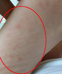 32�����б� �����ŵ׶���һ����ɫ��С��