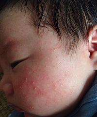 �����±���ʪ��