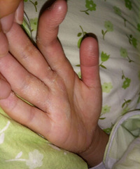 9��С���ֲ�������Ƥ ������ɶԭ��?����Ϳɶҩ?