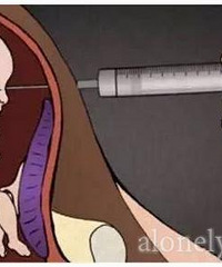 ����5�껳����̥ȴ�Ϲ�����ȥ���� ԭ��������ŭ�ˣ�