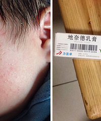 �����±���ʪ�������  ��2��ҩ�����ã�