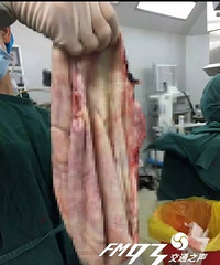 ��ŮͻȻ�����С� ������ġ����ӡ���Ȼ��20�๫��