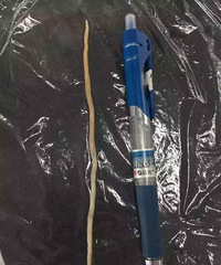 ����2����ͯ��ʪ��10�����װ׳�