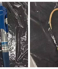 ����2����ͯ��ʪ��10�����װ׳�