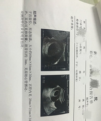 ����һ��Ҫ׼3������