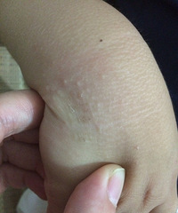 ����ҽ�� ��Щһ��һ������ɶ���ǲ���ë��