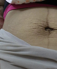 ���꺢�Ӷ������ɿ�� �ѿ�����