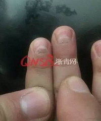 4���к���ָ��ͻȻ��ʼһ�������� ԭ������Ϊ֮ǰ�ù����