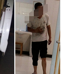 ���׽ڣ����ӽ���ȭ��Ѹ��״��ҽԺ