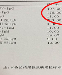 ������챨���æ����� ��ָ�л��