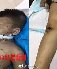 6����ͯ�������Ű�� �Դ����ر���