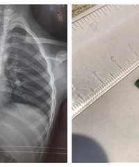 ���Ӳ���������  3���׳��Ĺ������������