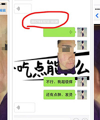 做某美容院做完面部护理 我惨遭“毁容”